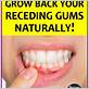 cure gum disease natu