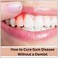 cure gum disease without dentist