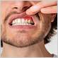 danville gum disease treatments