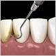 deerfield gum disease treatment