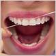 dental crowns flossing daily