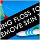 dental floss around labial skin tag