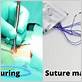 dental floss as suture material