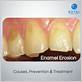dental floss damage enamel