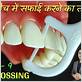 dental floss definition in hindi