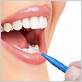 dental floss or interdental brush