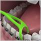 dental floss retainer