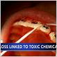dental floss toxic chemical