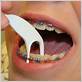 dental flosser for braces