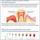 dental gum disease chart