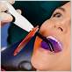 dental laser power for different effects