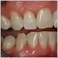 dental negligence gum disease