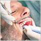 dental pockets treatment