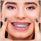 dental power chain braces rubber