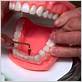 dental rubber tip