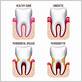 difference between gum disease and gingivitis