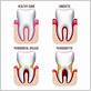 difference between gum disease and periodontal disease
