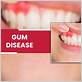 diseases associated with gum tags