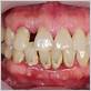 diseases of the gums scottsdale az