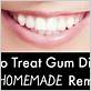 diy get rid of gum disease