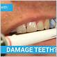 do electric toothbrush damage teeth