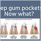 do gum pockets heal