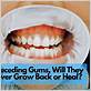 do gums heal on their own