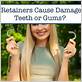 do permanent retainers cause gum disease