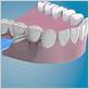 do you brush dental implants