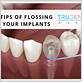 do you floss dental implants