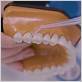 do you use waterpik behind teeth