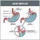 does acid reflux cause gum disease