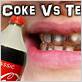 does coca cola cause gum disease
