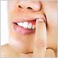 does coq10 help gum disease