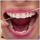does flossing improve dental health