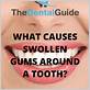 does gum disease cause swollen glands