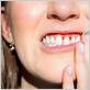 does gum disease make your teeth hurt