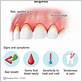 does gum disease stop when teeth are removed