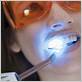 does laser therapy work for gum disease