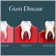 does periodontal disease cause swollen gums
