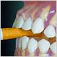 does secondhand smoke cause gum disease