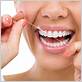 does water flossing help gums