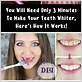 does water flossing make your teeth whiter