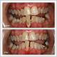 dr shultz's gum disease