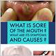dry mouth modafinil gum disease