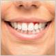 durham gum disease treatment