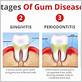 early stage before and after gum disease