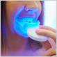 electric teeth whitening