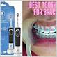 electric toothbrush with braces yahoo