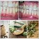 eucalyptus oil for gum disease